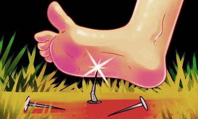 اختراق مسمار للقدم