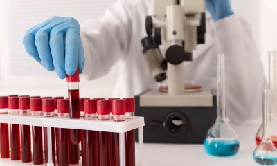 تجلط الدم بسبب التفاعل الدوائي