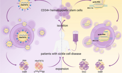 أول علاجين جينيين لعلاج مرضى فقر الدم المنجلي