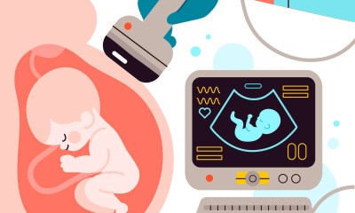 استخدام الموجات فوق الصوتية (السونار) للاطمئان على الجنين