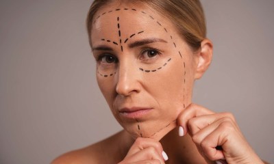 ترهل الوجه بسبب  خسارة الوزن السريعة