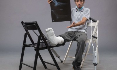 كسور العظام