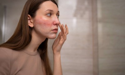 وضع مرهم مضاد للبكتيريا