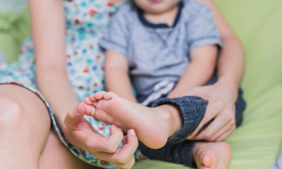 النقرس عند الأطفال