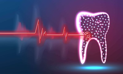 علاقة حشو عصب الأسنان بصحة القلب