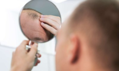 التساقط الكربي الحاد