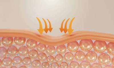 الإكسوسومات