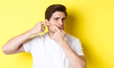 ظهور البثور للرجال