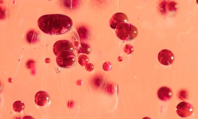 متلازمة نقص الصفائح الدموية