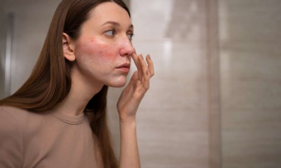 بقع حمراء على الجلد