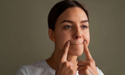 أسباب اسمرار الجلد حول الفم