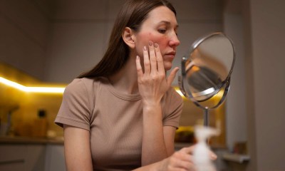 تهدئة تهيج البشرة