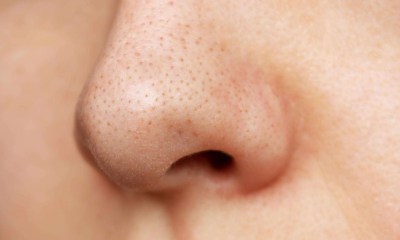 الرؤوس السوداء