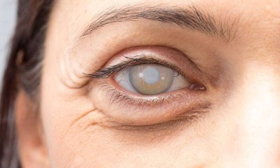 المياه الزرقاء