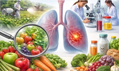 أورام الرئة