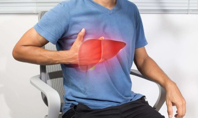 مرضى الكبد الدهني
