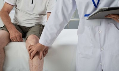 علاج خشونة وآلام المفاصل