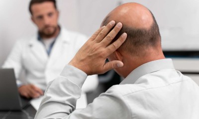 مرضى داء الثعلبة