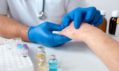 تطعيمات الحصبة