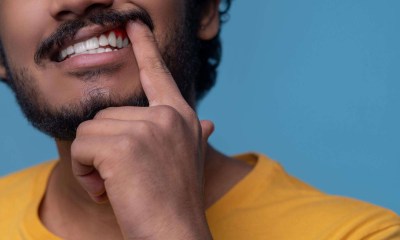 التهاب دواعم السن
