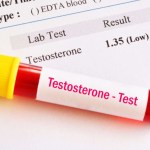 مخاطر الصيام المتقطع على هرمون التستوستيرون