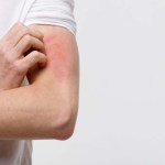 5 أطعمة تساعد في علاج الالتهابات المزمنة