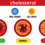 تمارين الكارديو والمقاومة للكوليسترول الضار 