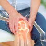 مُغذّي حيوي يقلل ألم التهاب المفاصل