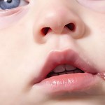 ما هي القرح الباردة التي يصاب بها بعض الأطفال؟