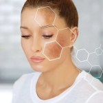التخلص من البقع الداكنة بعد علاج الأكزيما