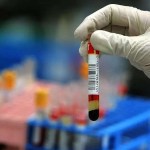 اختبار دم جديد يتنبأ بالمخاطر الصحية قصيرة المدى لكبار السن