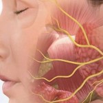 هل التعرض للهواء البارد يسبب شلل الوجه؟