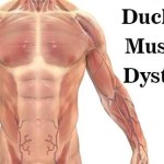 لماذا رفضت الـFDA دواء Deramiocel لعلاج ضمور العضلات الدوشيني؟