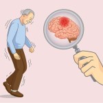 شيخوخة الدماغ تزيد خطر الزهايمر والوفاة المبكرة