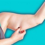 كيف تتخلصين من دهون الذراعين؟