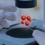 دواء Gazvya للذئبة الحمراء 