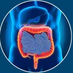 الأعراض المبكرة لمرض التهاب الأمعاء