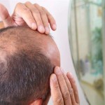 مكملات البروتين ترفع الهرمون الرئيسي المسبب للصلع عند الرجال