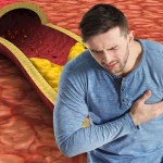 ما العلاقة بين مستويات الكوليسترول وهرمون التستوستيرون لدى الرجال؟