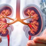 علاج الكلى بالترددات الراديوية 