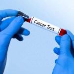 ملايين الأشخاص يحملون خطرًا خفيًا للإصابة بالأورام