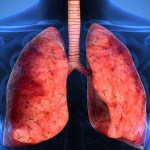 دواء Jascayd لعلاج التليف الرئوي مجهول السبب