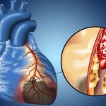 5 عادات يومية تقيك من انسداد الشرايين وأمراض القلب
