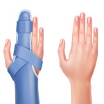 دعامة أصبع مرنة مبتكرة