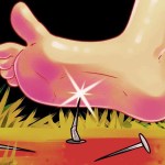 اختراق مسمار للقدم