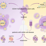 أول علاجين جينيين لعلاج مرضى فقر الدم المنجلي
