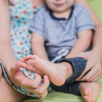 النقرس عند الأطفال