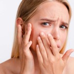 علاج جفاف البشرة 