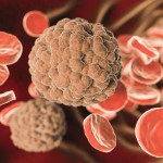علاج جديد للمصابين بورم الدم النخاعي الحاد
