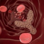 الدهون الثلاثية في الدم